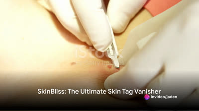 Skin Bliss Skin Tag Remover